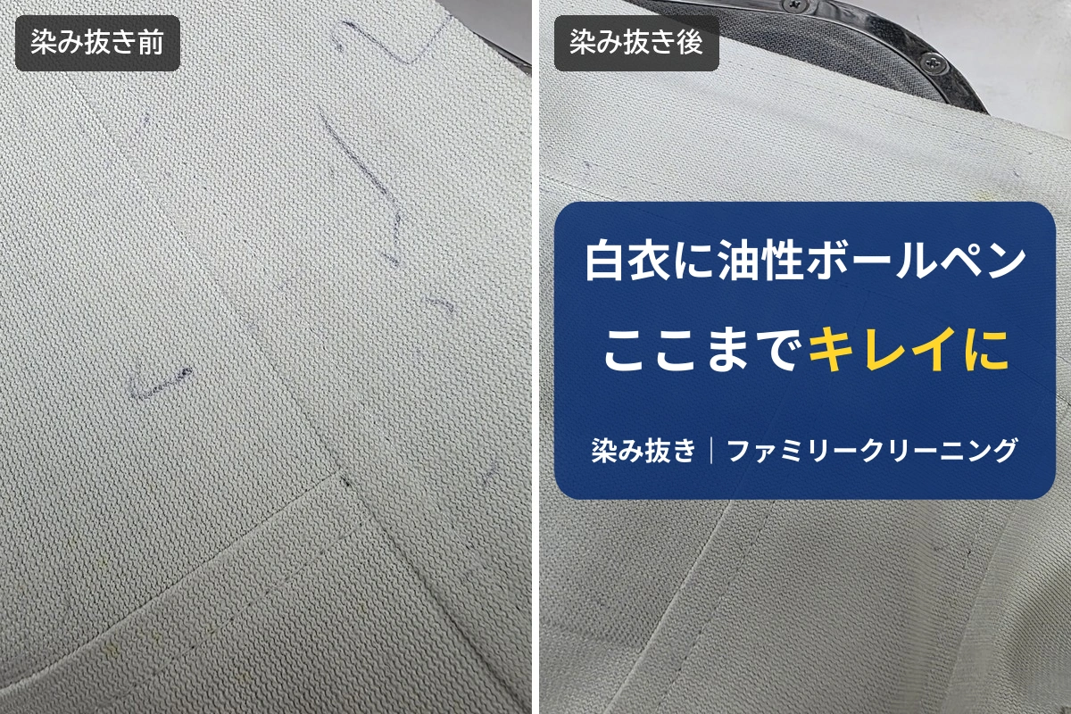 白衣についた油性ボールペンの線（左）と、染み抜き後の同じあたり（右）。右側に「白衣に油性ボールペン ここまでキレイに」の文字